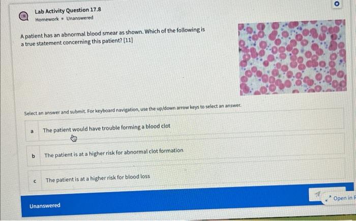 Lab Activity Question 17 8 Homework Unanswered A Patient Has An Abnormal Blood Smear As Shown Which Of The Following Is 1