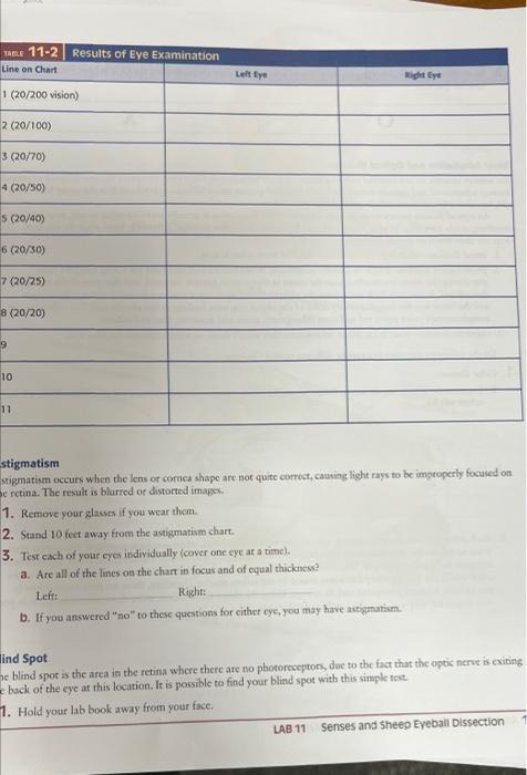 Table 11 2 Results Of Eye Examination Line On Chart 1 20 200 Vision 2 20 100 3 20 70 4 20 50 S 20 40 6 20 30 1