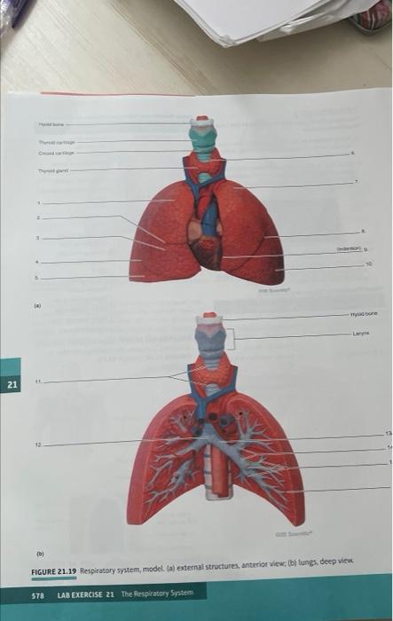21 Th Tyd Gent Ondern Lary B Figure 21 19 Respiratory System Model A External Structures Anterior View B Lung 1