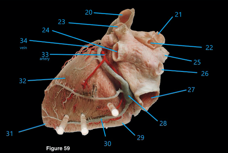 Please Label The Sheep Heart Question 13 15 And 20 34 Sheep Heart Dissection Assignment Many Thanks 2