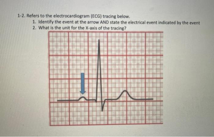 1 2 Refers To The Electrocardiogram Ecg Tracing Below 1 Identify The Event At The Arrow And State The Electrical Ev 1