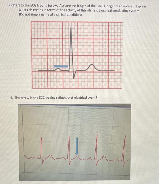 1 2 Refers To The Electrocardiogram Ecg Tracing Below 1 Identify The Event At The Arrow And State The Electrical Ev 2