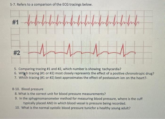 1 2 Refers To The Electrocardiogram Ecg Tracing Below 1 Identify The Event At The Arrow And State The Electrical Ev 3