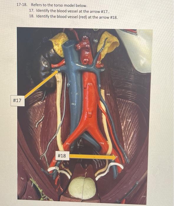 1 2 Refers To The Electrocardiogram Ecg Tracing Below 1 Identify The Event At The Arrow And State The Electrical Ev 7