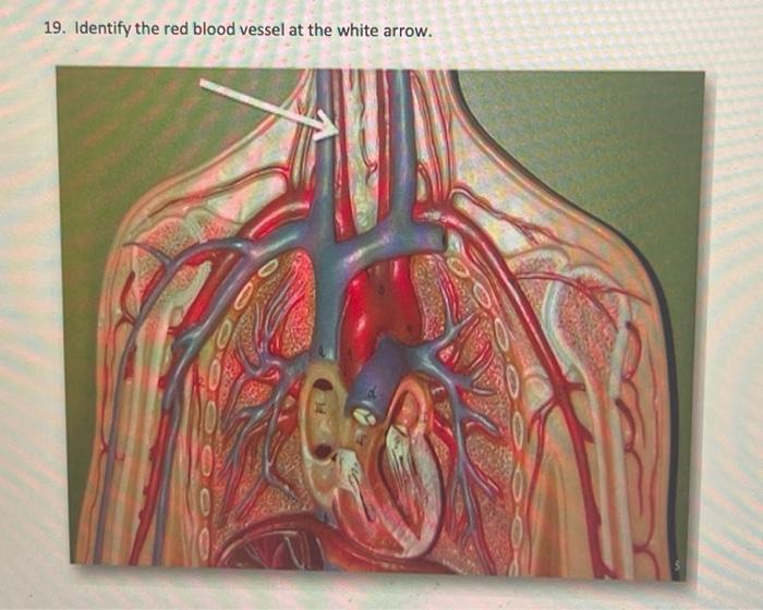 1 2 Refers To The Electrocardiogram Ecg Tracing Below 1 Identify The Event At The Arrow And State The Electrical Ev 8