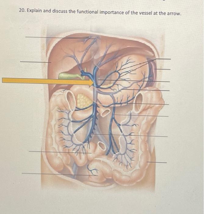 1 2 Refers To The Electrocardiogram Ecg Tracing Below 1 Identify The Event At The Arrow And State The Electrical Ev 9