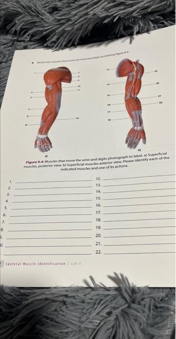 At Flgure 9 4 Muscles That Move The Wrict And Dig Ts Photograph To Labek A Superficial Mitricles Pouterioe View By Su 1