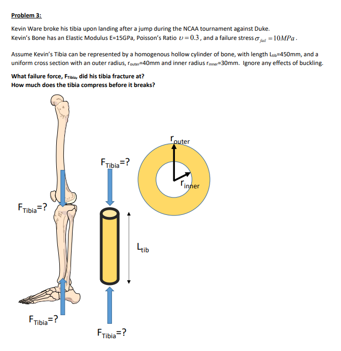Problem 3 Kevin Ware Broke His Tibia Upon Landing After A Jump During The Ncaa Tournament Against Duke Kevin S Bone Ha 1