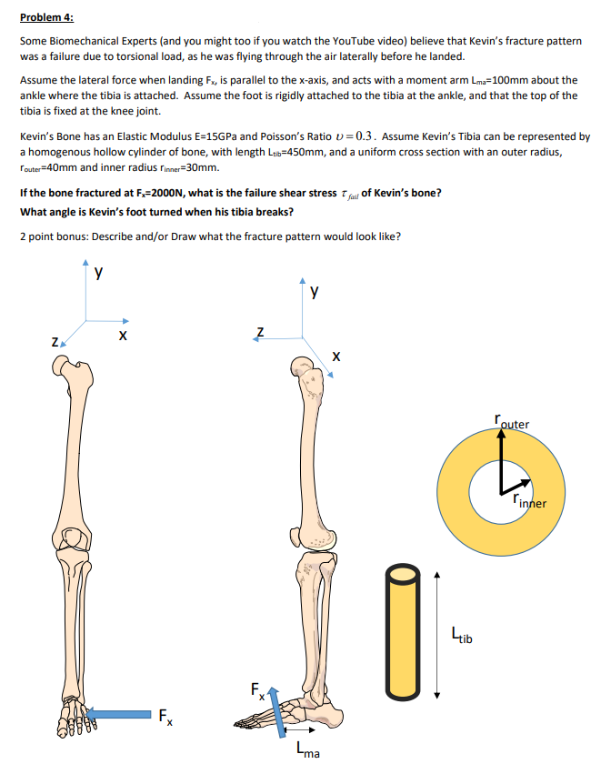 Problem 4 Some Biomechanical Experts And You Might Too If You Watch The Youtube Video Believe That Kevin S Fracture P 1