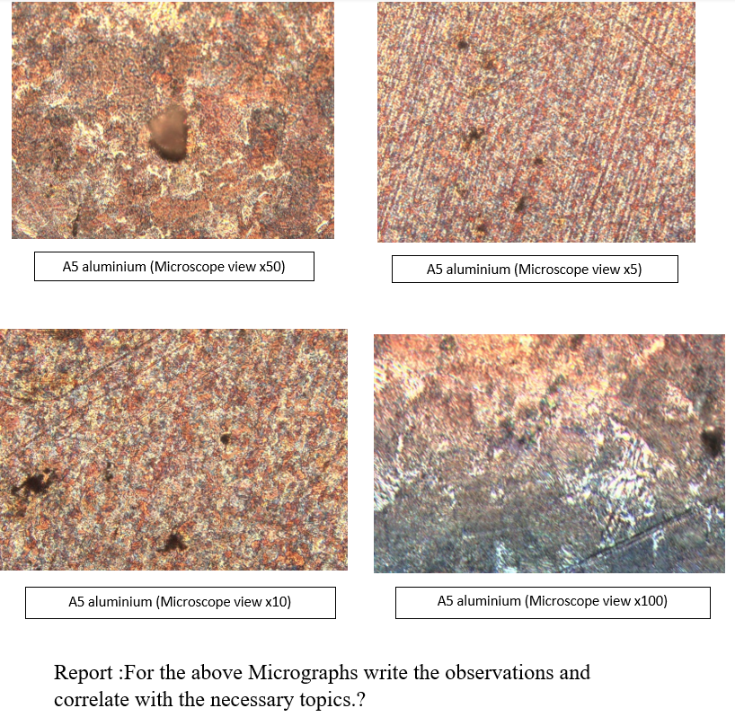 Report For The Above Micrographs Write The Observations And Correlate With The Necessary Topics 1