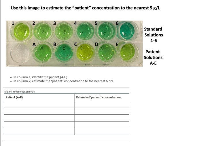 Use This Image To Estimate The Patient Concentration To The Nearest 5 G L Ard Ons I Nt Ons In Column 1 Identify The 1