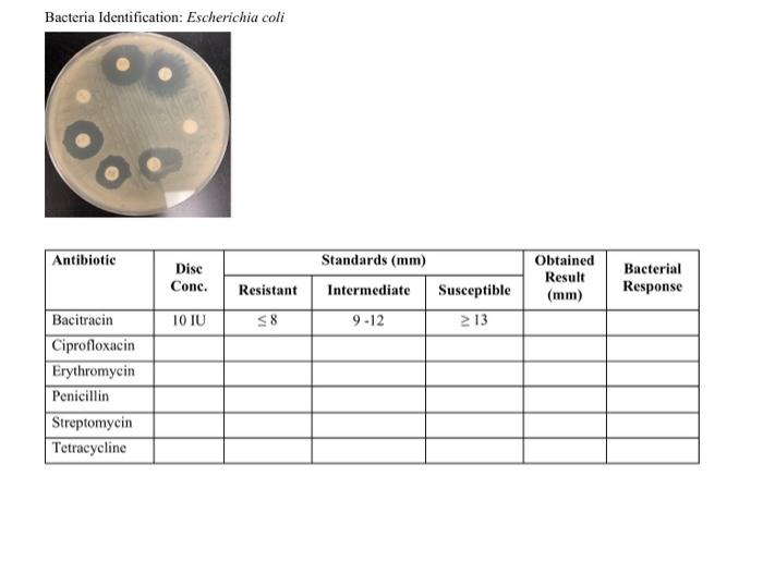 Standards For Antimicrobial Disc Diffusion Susceptibility Tests Tror Ctarryoceco Vor Erieromono Rey Stactionoco Exampl 6