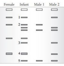 An Infant Was Born To A Female Chimpanzee In Captivity The Dna From Two Male Chimpanzees Along With The Female And Inf 1