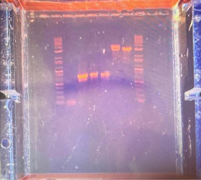 Please Help Label The Chart With The Gel 1