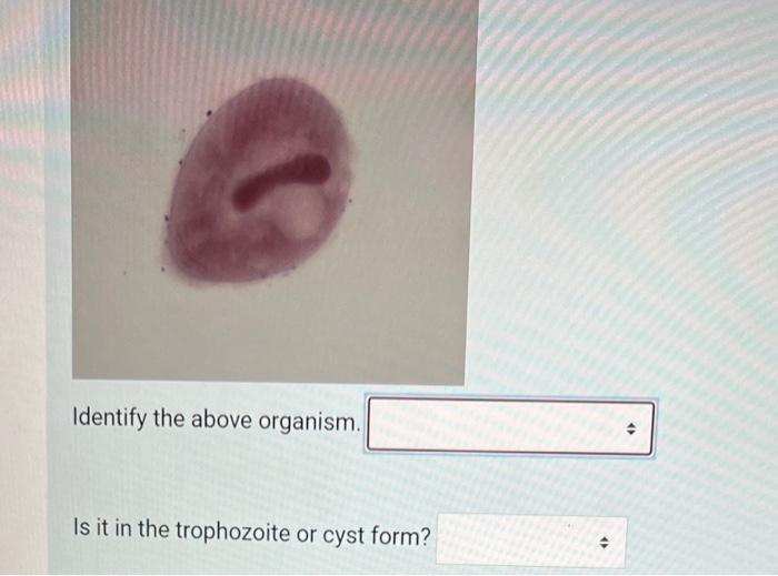 Is It In The Trophozoite Or Cyst Form Identify The Above Organism Is It In The Trophozoite Or Cyst 1