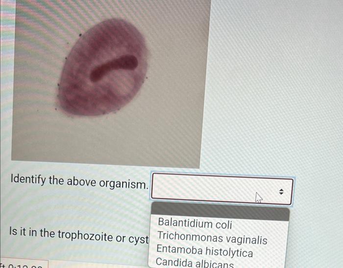 Is It In The Trophozoite Or Cyst Form Identify The Above Organism Is It In The Trophozoite Or Cyst 2