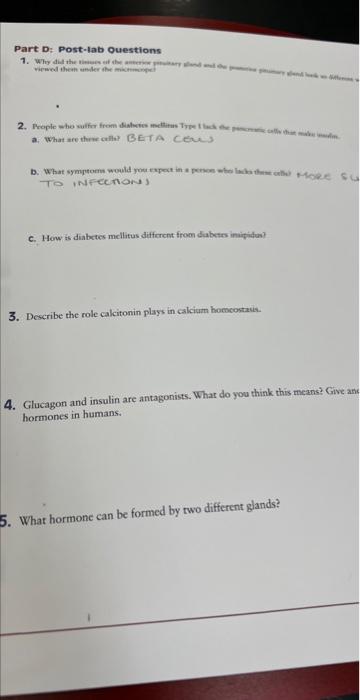 Part D Post Lab Questlons A What Are Threceill Beta Creas 3 To Inffections C How Is Diabetes Meilitus Ditferent From 1