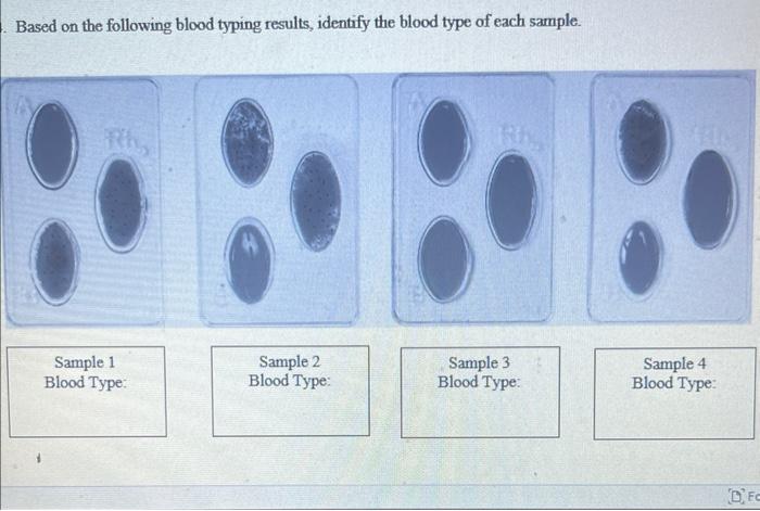 3 Complete The Following Chart Based On The Following Blood Typing Results Identify The Blood Type Of Each Sample 2