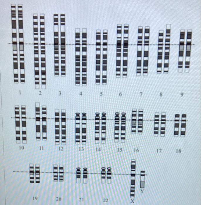 Provide The Proper Chromosomal Designation And Genetic Condition For I And Ii If Applicable For The Two Karyotypes 2