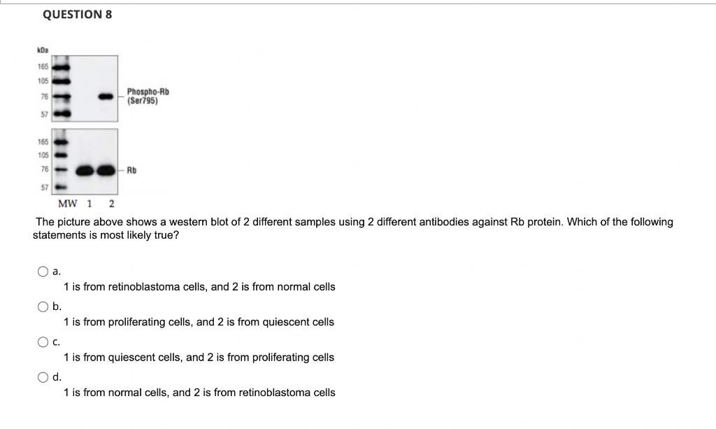 Question 8 The Picture Above Shows A Western Blot Of 2 Different Samples Using 2 Different Antibodies Against Rb Protein 1
