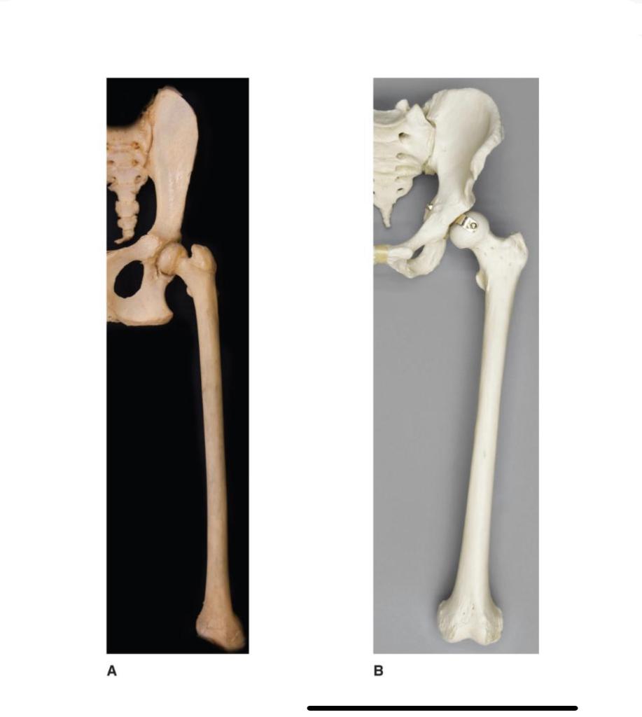 Exercise 5 Bipedal Adaptations Of The Femur Examine The Skeletal Material Provided By Your Instructor Or The Photos In 1