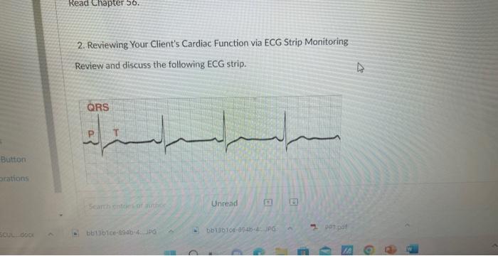 2 Reviewing Your Client S Cardiac Function Via Ecg Strip Monitoring Review And Discuss The Following Ecg Strip 1