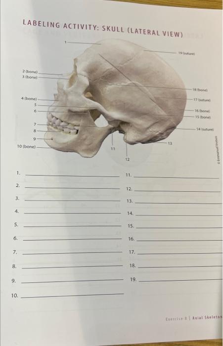 Labeling Activity Skull Lateral View 1 1 11 2 12 3 13 4 14 5 15 6 16 7 17 8 18 9 19 10 Eateristert 1