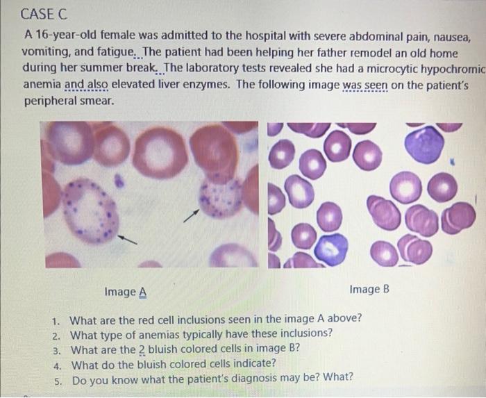 Casec A 16 Year Old Female Was Admitted To The Hospital With Severe Abdominal Pain Nausea Vomiting And Fatigue The P 1