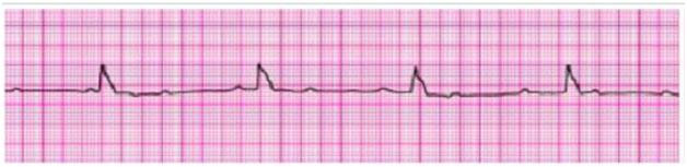 This Patient Su 1