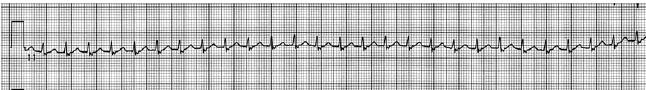 A Patient Has T 1