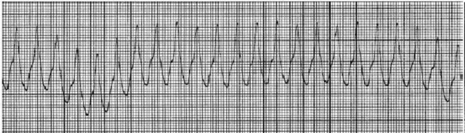 A Patient With  1