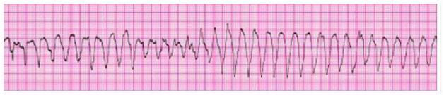 This Patient Wa 1