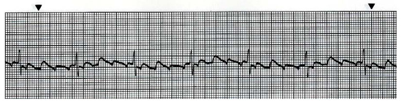 Following Resus 1