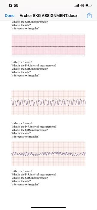 12 55 Ll 4g Done Archer Ekg Assignment Docx What Is The Ors Measurement What Is The Rate Is It Regular Or Irregular 1