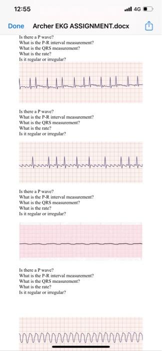 12 55 Ll 4g Done Archer Ekg Assignment Docx What Is The Ors Measurement What Is The Rate Is It Regular Or Irregular 3