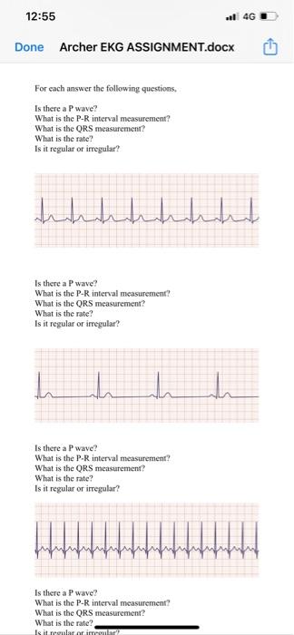 12 55 Ll 4g Done Archer Ekg Assignment Docx What Is The Ors Measurement What Is The Rate Is It Regular Or Irregular 4