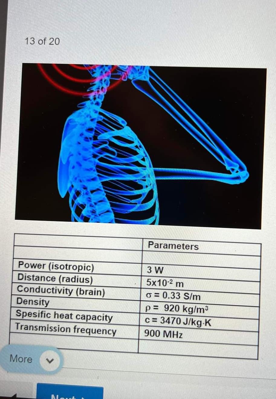 13 Of 20 Parameters Power Isotropic Distance Radius Conductivity Brain Density Spesific Heat Capacity Transmission 1